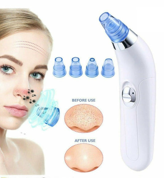 KTX-634643 Facial Pore Cleaner with Vacuum Suction for Acne and Skin Rejuvenation