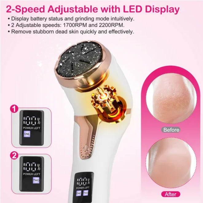 KTX-384531 17-Piece Electric Foot Callus Remover Set for Smooth and Soft Feet